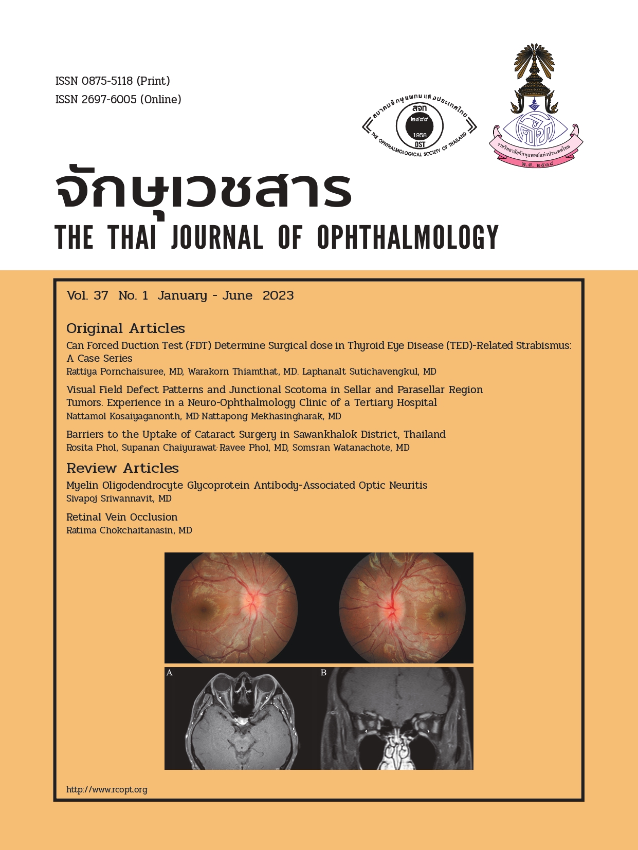 2041Cover J Ophthalmol-37-1-66-E7_page-0001.jpg